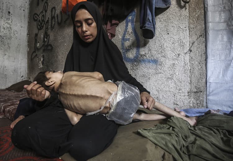Son 24 saatte 6 Gazzeli açlıktan öldü