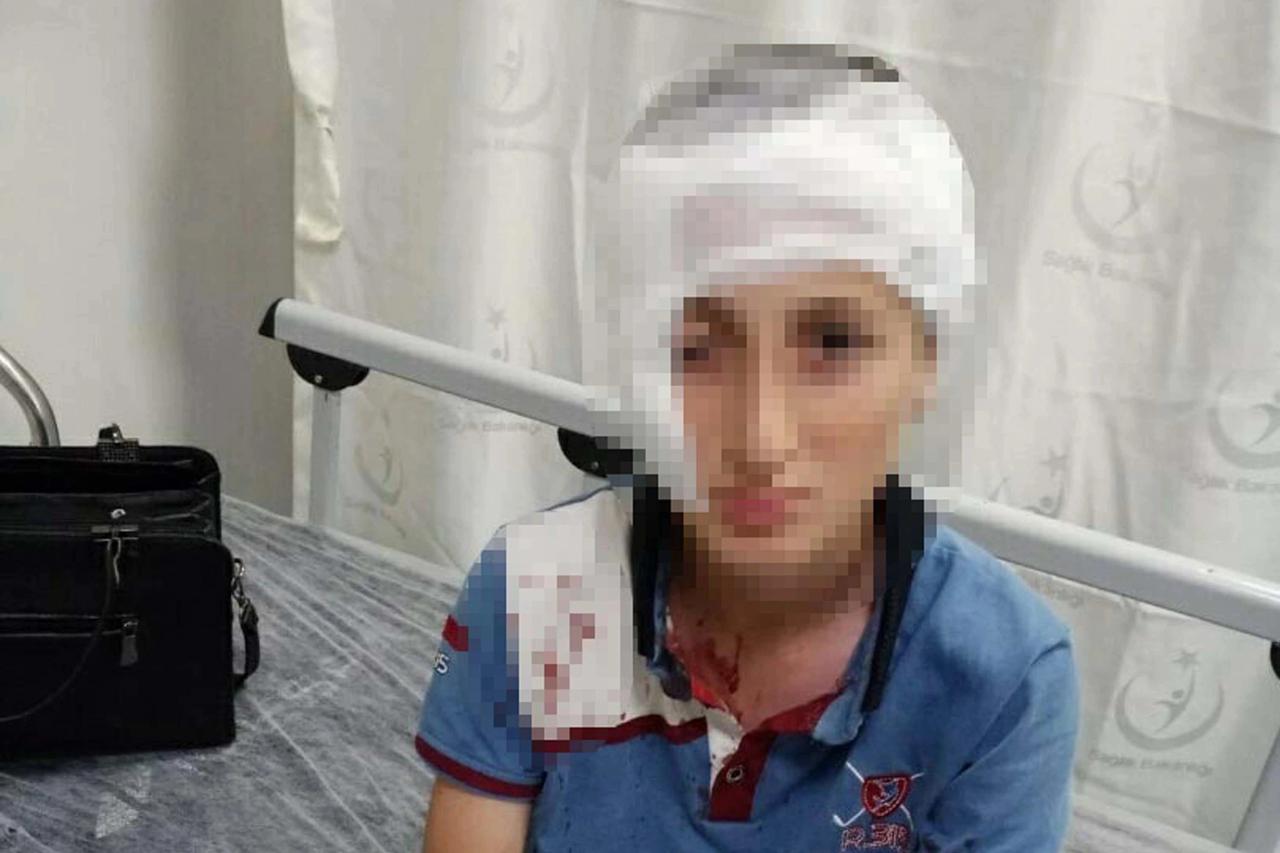 Köpek saldırısında emsal karar: 1,2 milyon TL tazminat cezası
