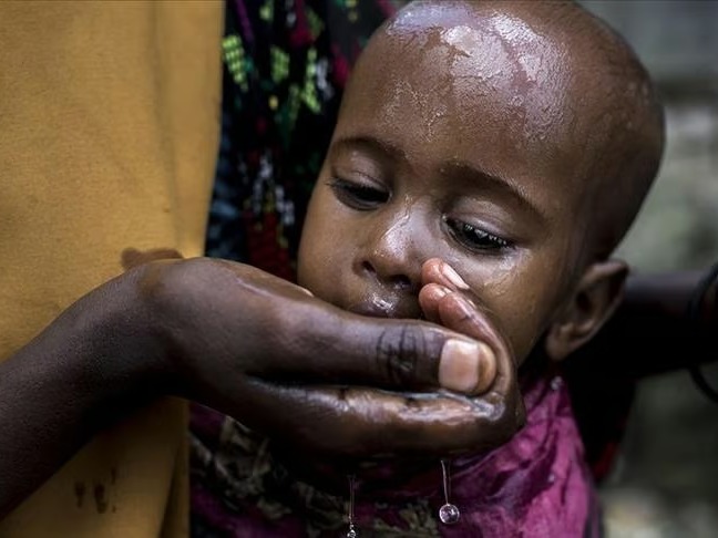 Sudan'da kolera alarmı: 1 milyon çocuk tehlikede