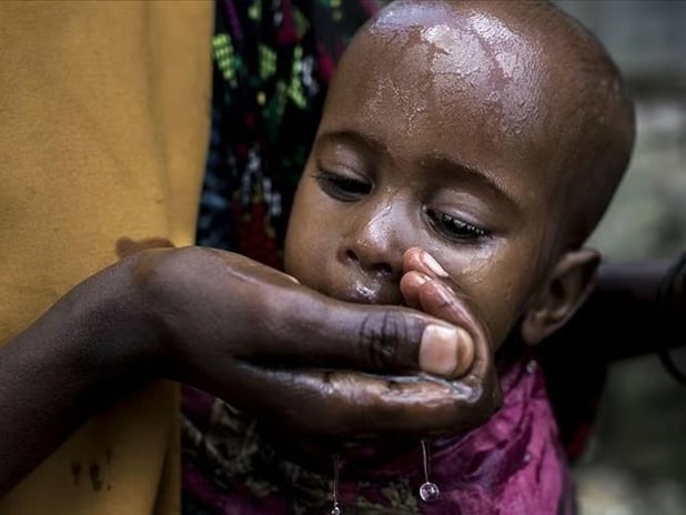 Sudan'da kolera alarmı: 1 milyon çocuk tehlikede