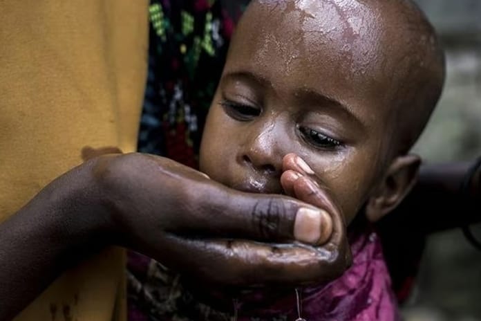 Sudan'da kolera alarmı: 1 milyon çocuk tehlikede