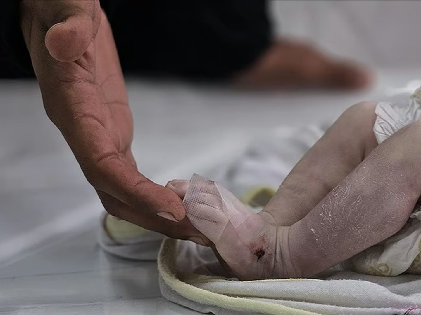 Gazze'de 5 aylık bir bebek açlıktan öldü