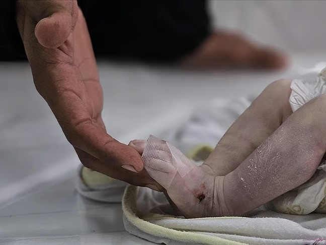 Gazze'de 5 aylık bir bebek açlıktan öldü