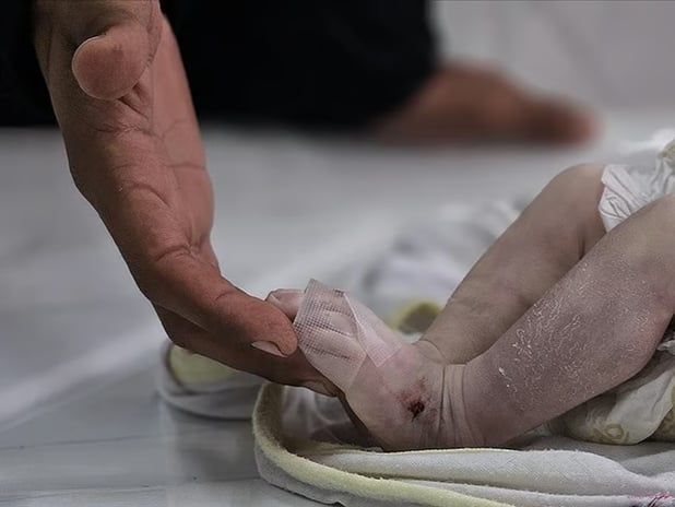 Gazze'de 5 aylık bir bebek açlıktan öldü