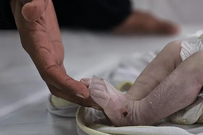 Gazze'de 5 aylık bir bebek açlıktan öldü