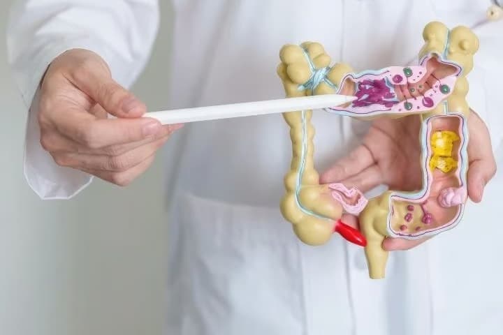 Tedaviye yanıtı doğrudan etkiliyor: Probiyotik her hastaya uygun değil