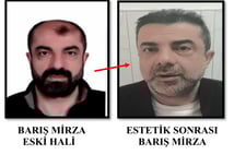 Estetik ameliyatla yüzünü değiştirmiş! Cinayet azmettiricisi yıllar sonra yakalandı