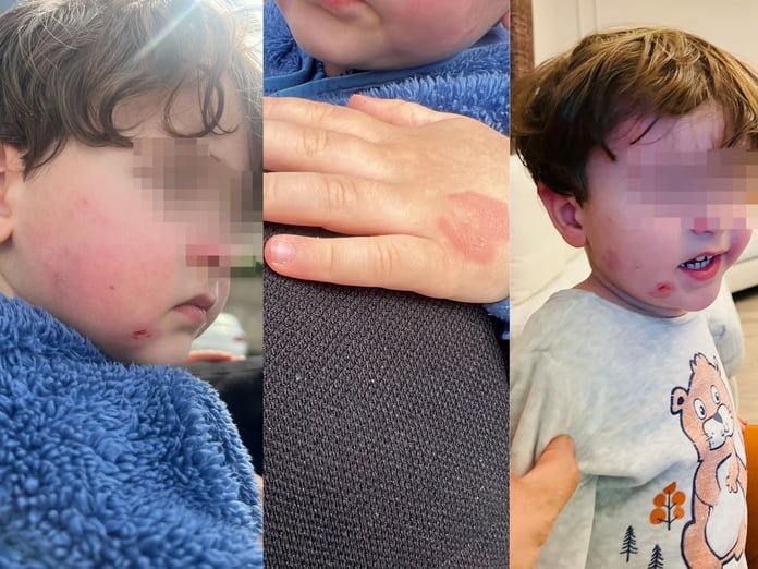 Sabah sağlıklı bıraktı, akşam morluklar içinde aldı! Gemlik’te kreş soruşturması