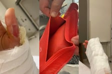 Sıcak su torbası hayatını karartıyordu: Genç kadının vücudu yandı 