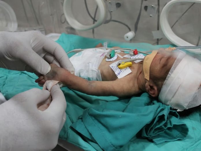 Gazzeli bebekler için son çağrı: 48 saat içinde ölümler başlayabilir