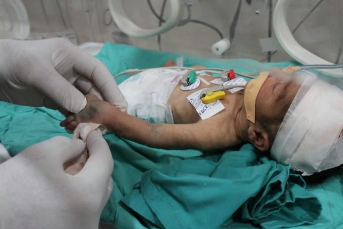 Gazzeli bebekler için son çağrı: 48 saat içinde ölümler başlayabilir