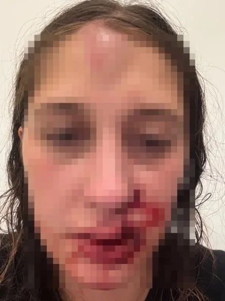 Dilara sosyal medya olayı nedir