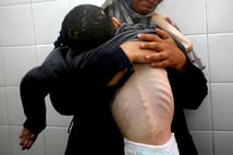 Gazze'de açlıktan ölenlerin sayısı 348’e çıktı