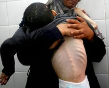 Gazze'de açlıktan ölenlerin sayısı 348’e çıktı