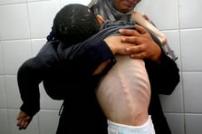 Gazze'de açlıktan ölenlerin sayısı 348’e çıktı