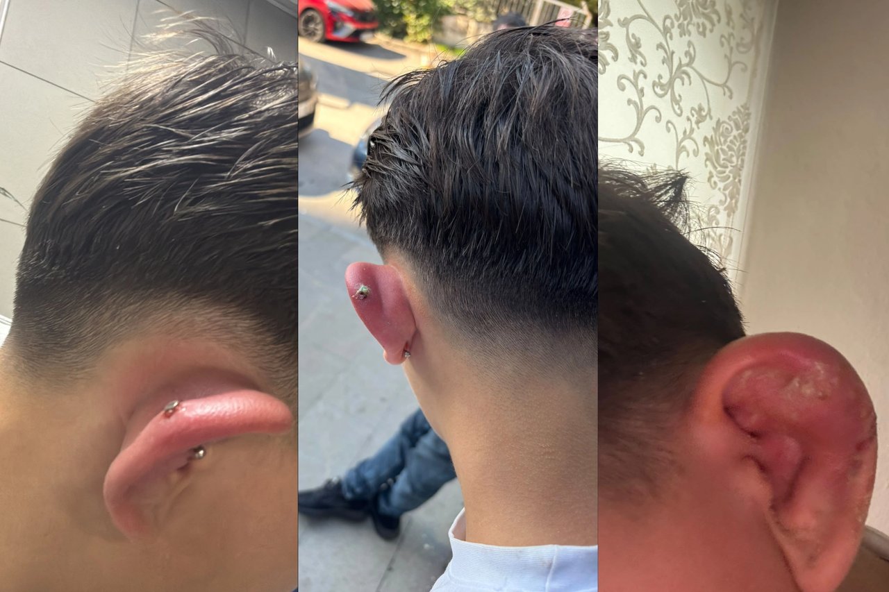 Piercing yaptıran çocuk hastanelik oldu