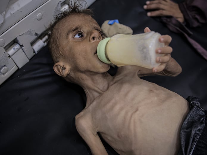 Gazze'de açlıktan ölenlerin sayısı 289'a yükseldi
