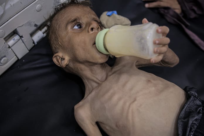 Gazze'de açlıktan ölenlerin sayısı 289'a yükseldi