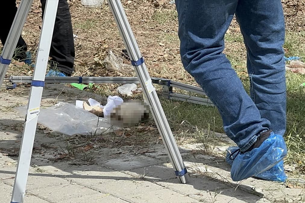 Adana'da çöp konteynerinden kafatası çıktı