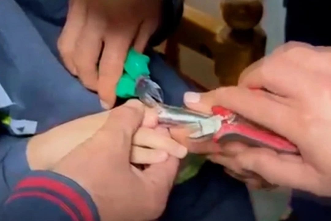 Boruya sıkışan parmak kurtarıldı