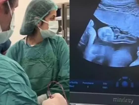 Anne karnında kan nakliyle kurtarıldı