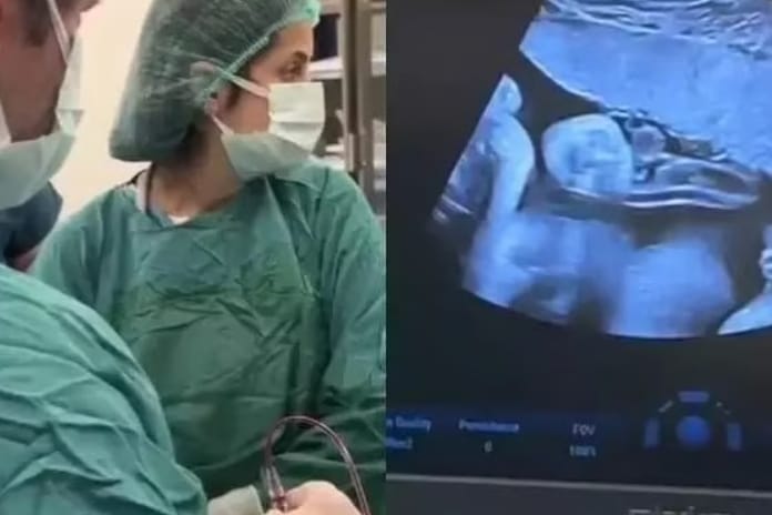 Mucize operasyon: Anne karnındaki 8 aylık bebeğe kan nakli