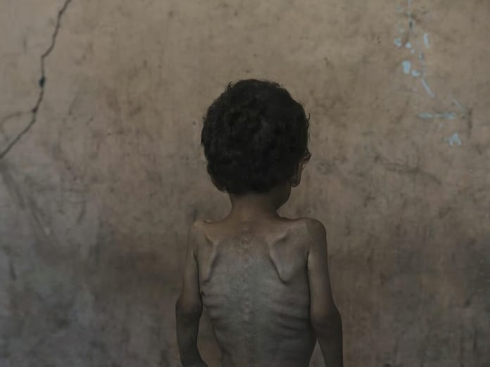 VOX: Tarihte açlığın silah olarak kullanılması ve İsrail