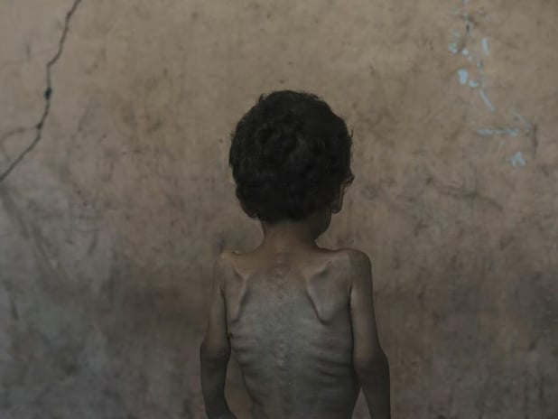 VOX: Tarihte açlığın silah olarak kullanılması ve İsrail