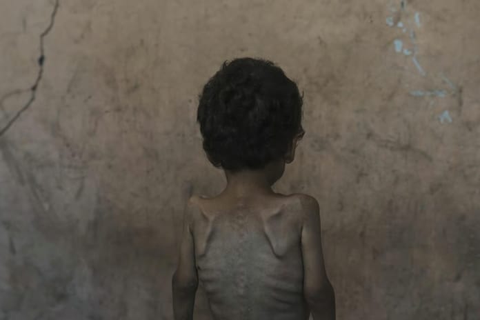 VOX: Tarihte açlığın silah olarak kullanılması ve İsrail