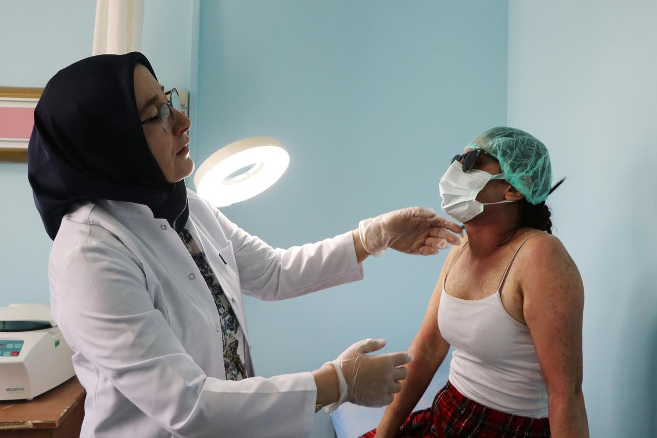 İnternetten aldığı krem hastanelik etti