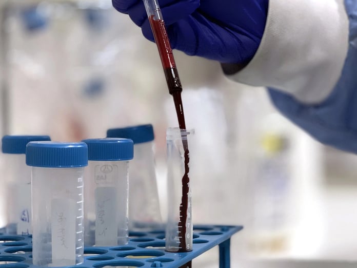 Küresel araştırma uyardı: 2050'de kanser vakaları 30 milyonu aşacak