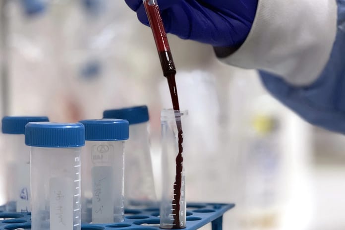 Küresel araştırma uyardı: 2050'de kanser vakaları 30 milyonu aşacak