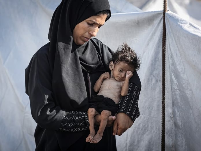 Gazze'de açlıktan ölenlerin sayısı 201'e ulaştı