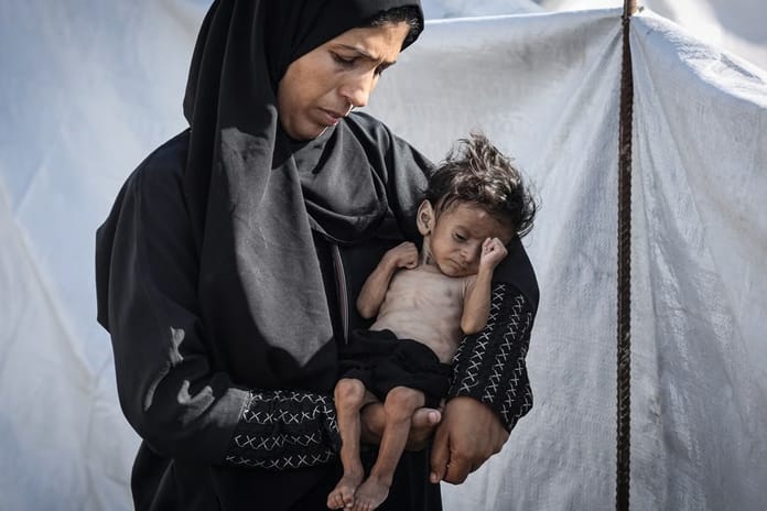 Gazze'de açlıktan ölenlerin sayısı 201'e ulaştı