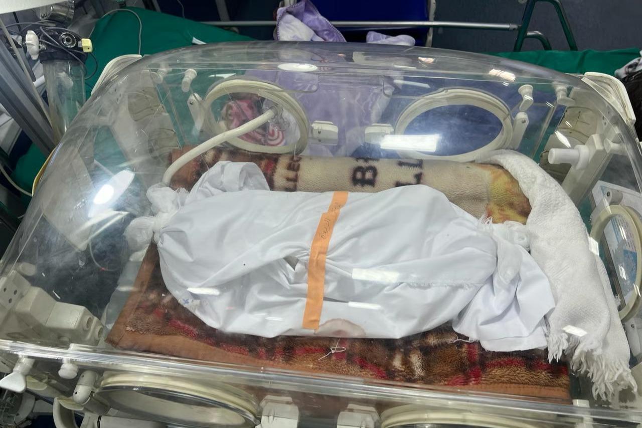 Gazzeli bebekler açlıktan ölüyor