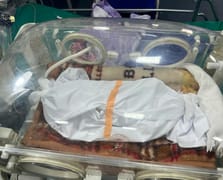 Gazze'de açlıktan ölen bebeklerin sayısı artıyor