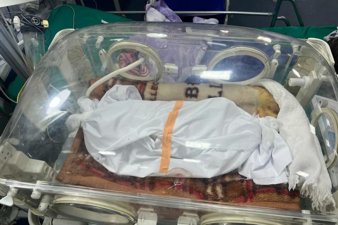 Gazze'de açlıktan ölen bebeklerin sayısı artıyor