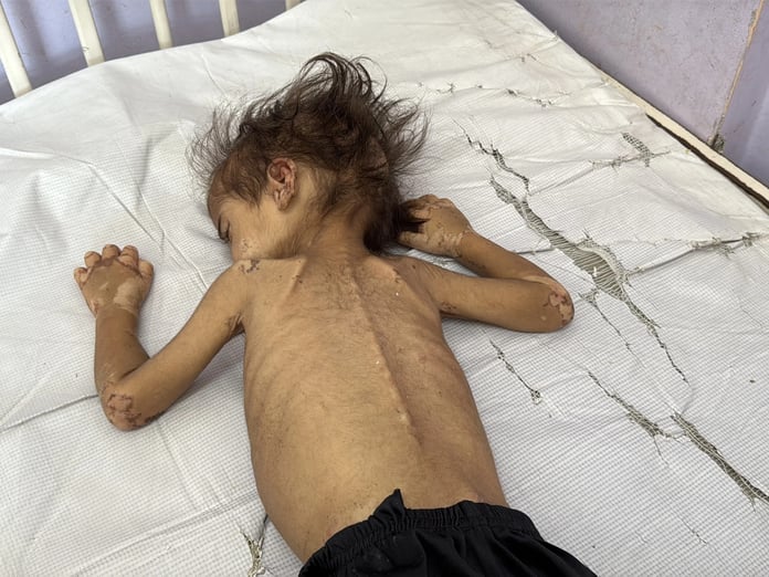 Gazze Şeridi'nde son 24 saatte 2 kişi açlıktan hayatını kaybetti