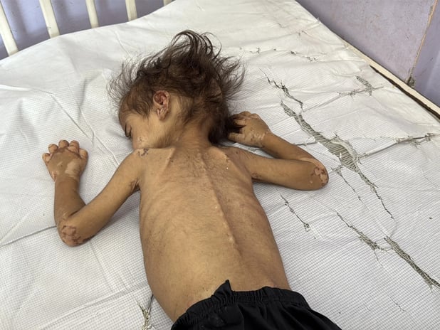 Gazze Şeridi'nde son 24 saatte 2 kişi açlıktan hayatını kaybetti