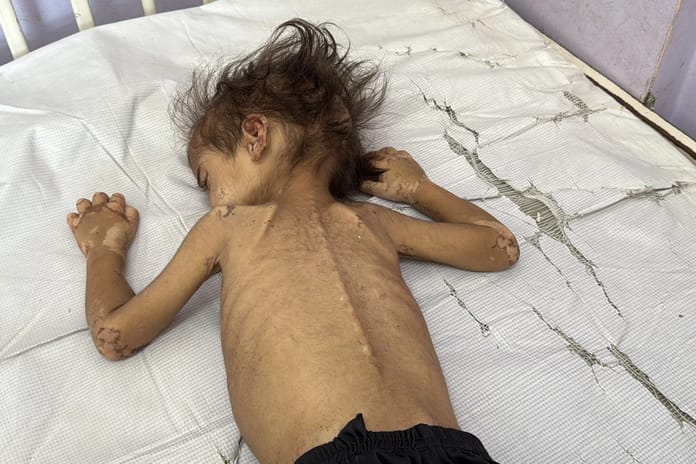 Gazze Şeridi'nde son 24 saatte 2 kişi açlıktan hayatını kaybetti