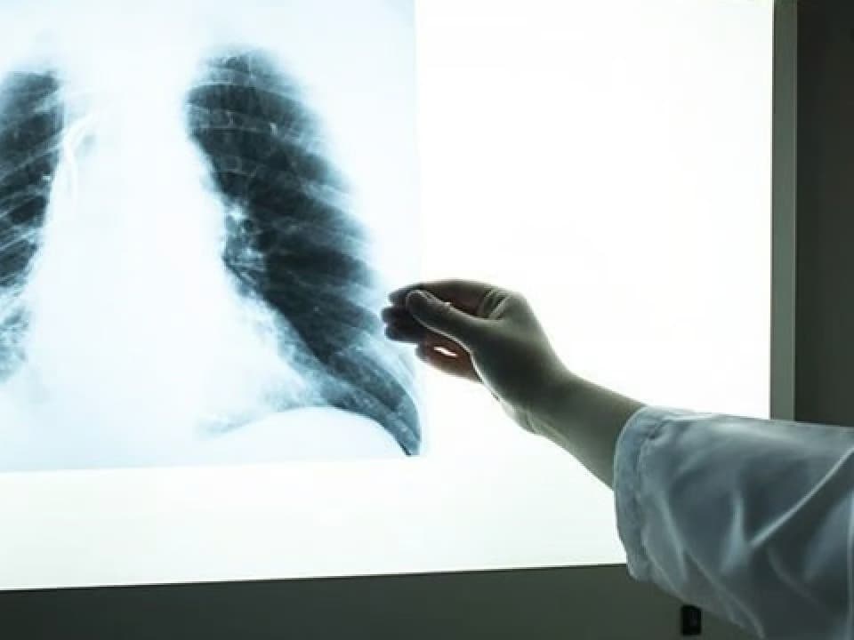 50 yaş altı kanserin arkasındaki gizli suçlu bulundu