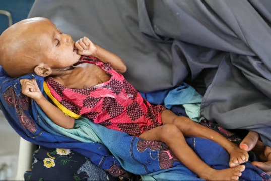 Cholera Outbreak Puts 80,000 Children At Risk In West Africa