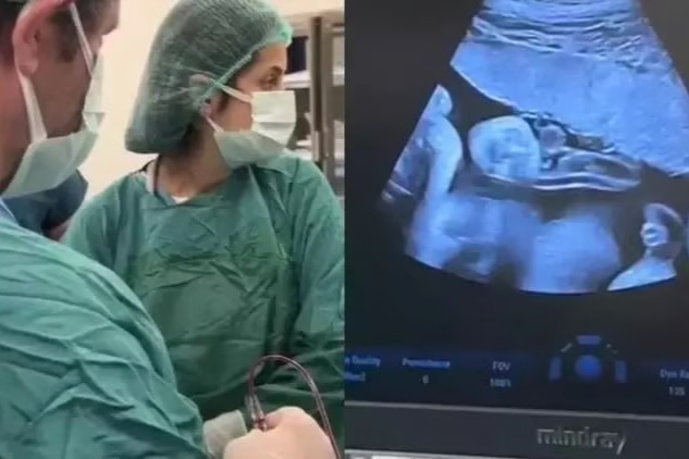 Anne karnında kan nakliyle kurtarıldı