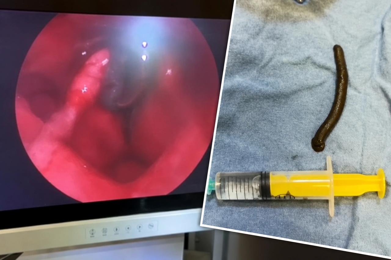 Şiddetli ağrı ve kanamayla gitti, doktorlar şaşkına döndü!