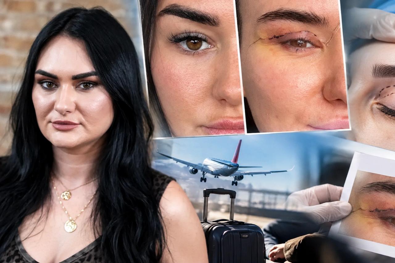 750 euroya ameliyat oldu, uçağa bindiğinde gözlerinden kan geldi! Sosyal medyadaki ucuz estetik tuzağı