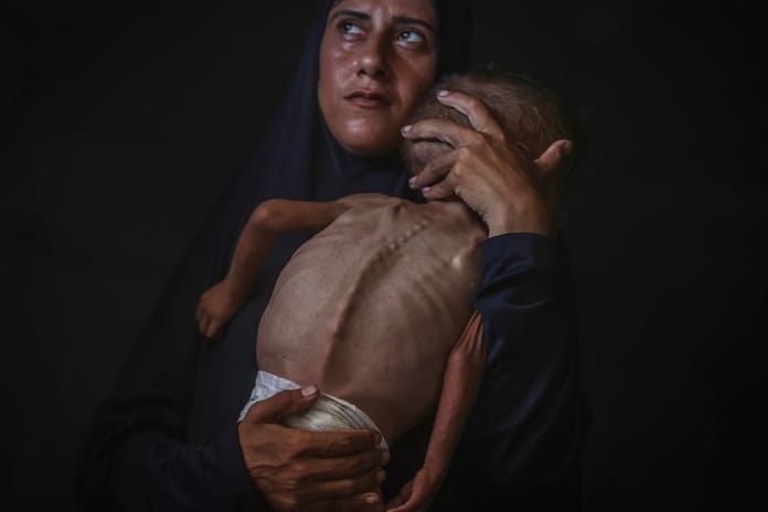 Guterres: Kelimeler Gazze’deki aç çocukları doyurmuyor