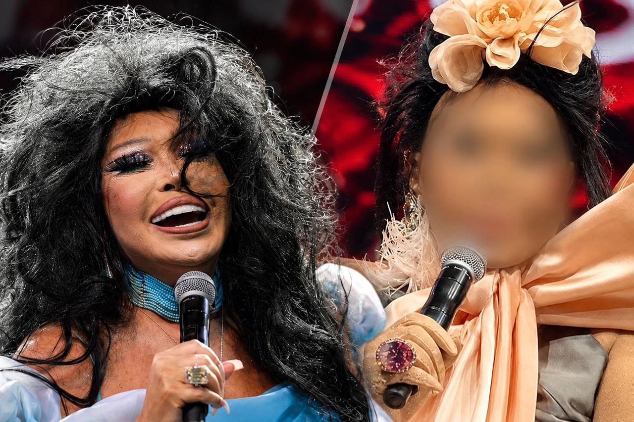 Konser görüntülerindeki son hali gündemde! Bülent Ersoy'un yüzüne ne oldu, estetik mi yaptırdı?