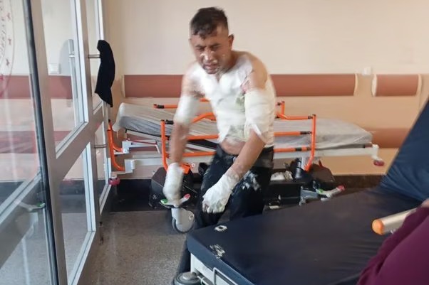 Engelli vatandaşın önce telefonunu çaldı sonra cani bir şekilde benzin döküp yaktı