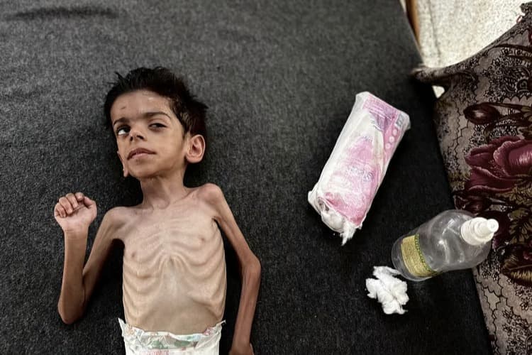 Gazze'de son 24 saatte 11 kişi açlıktan hayatını kaybetti