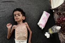 Gazze’de açlık can almaya devam ediyor: 24 saate 7 kişi açlıktan öldü